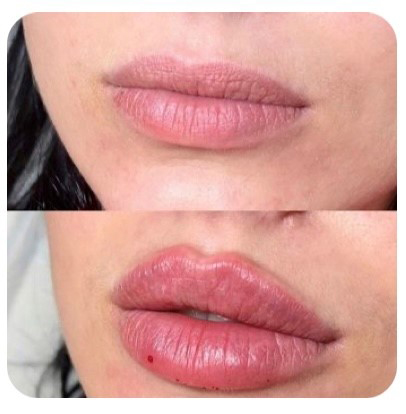 Barcelona-Cosmetica-huulten-muotoilu-ennen-ja-jälkeen